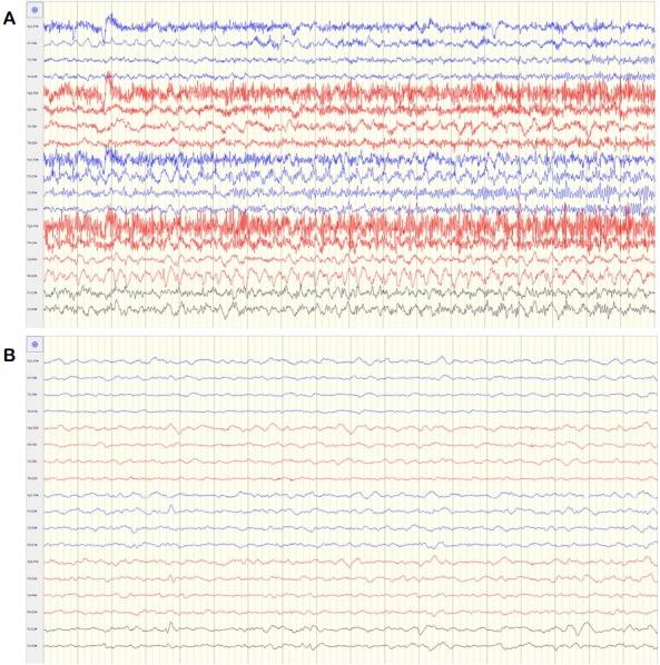 https://cdn.ncbi.nlm.nih.gov/pmc/blobs/e0dc/6374531/ed3e0ed229db/er-8-2-100f3.jpg
