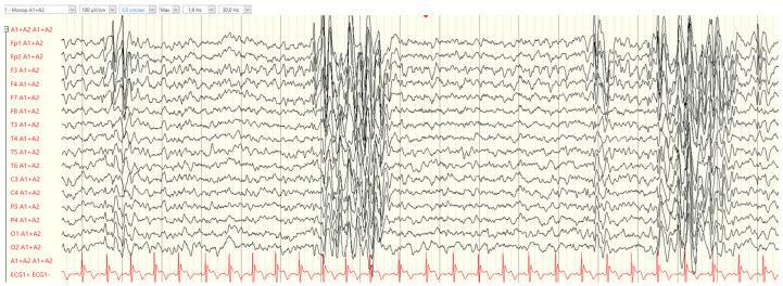 https://cdn.ncbi.nlm.nih.gov/pmc/blobs/e0df/11767995/02a48fe466e3/neurolint-17-00014-g002.jpg