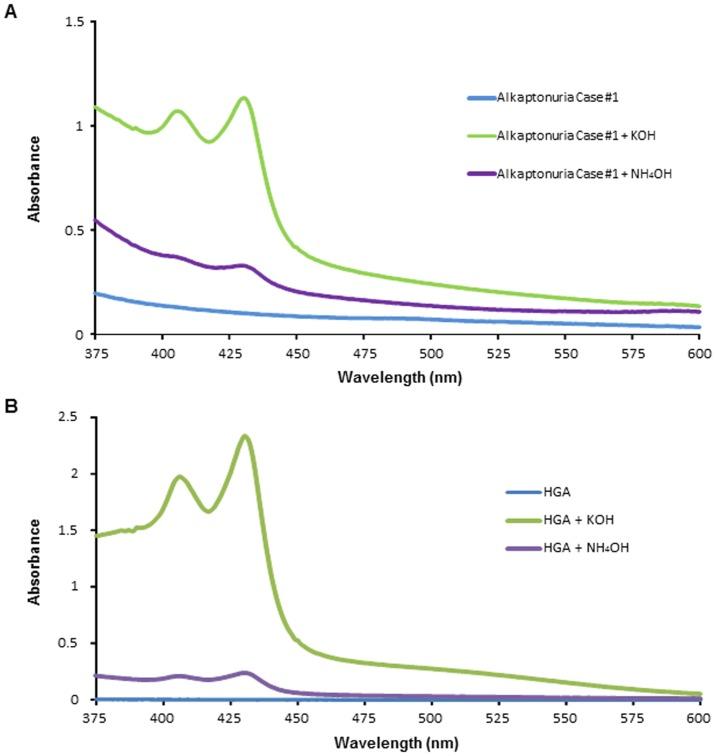 https://cdn.ncbi.nlm.nih.gov/pmc/blobs/e0df/3900575/373de286fe74/pone.0086606.g004.jpg