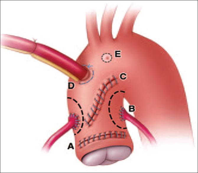 https://cdn.ncbi.nlm.nih.gov/pmc/blobs/e0df/8936863/e6538aa9e15a/AER-15-338-g003.jpg