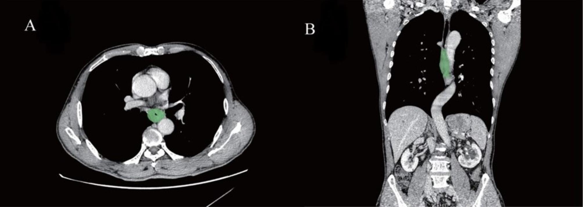 https://cdn.ncbi.nlm.nih.gov/pmc/blobs/e0e0/11841142/1d0b0b7e09c5/12885_2025_13697_Fig2_HTML.jpg