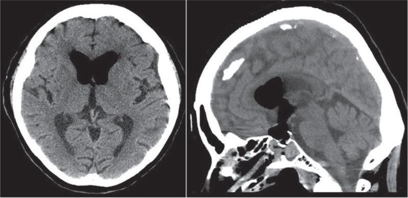 https://cdn.ncbi.nlm.nih.gov/pmc/blobs/e0e0/4533456/32845c739907/nmc-54-578-g3.jpg