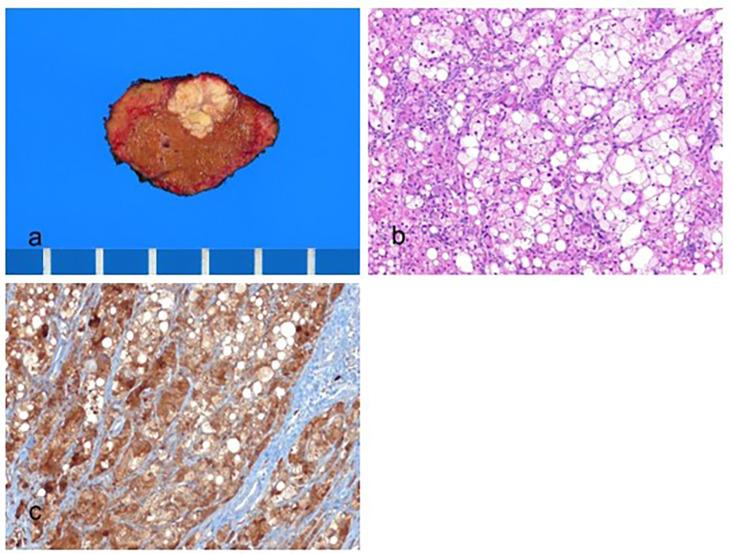 https://cdn.ncbi.nlm.nih.gov/pmc/blobs/e0e1/10526317/509343882406/biomedicines-11-02582-g002.jpg