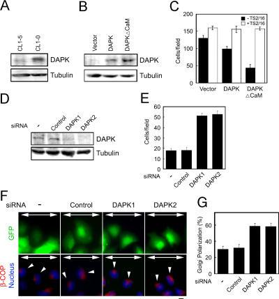 https://cdn.ncbi.nlm.nih.gov/pmc/blobs/e0e3/2063680/8d7828ab590c/jcb1720619f09.jpg
