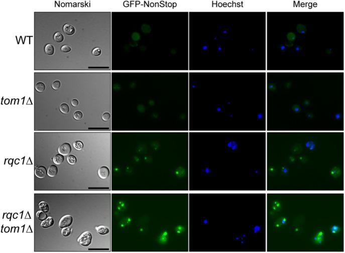 https://cdn.ncbi.nlm.nih.gov/pmc/blobs/e0e6/5415013/6634dabeb5bd/1165fig9.jpg