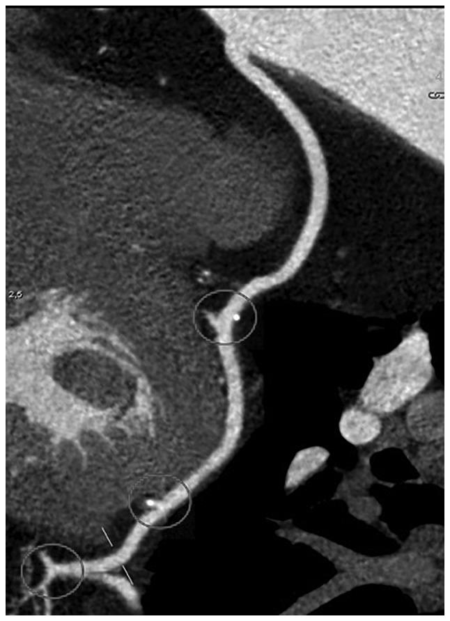 https://cdn.ncbi.nlm.nih.gov/pmc/blobs/e0e9/6307371/4f179b0f9bc1/etm-17-01-0359-g02.jpg