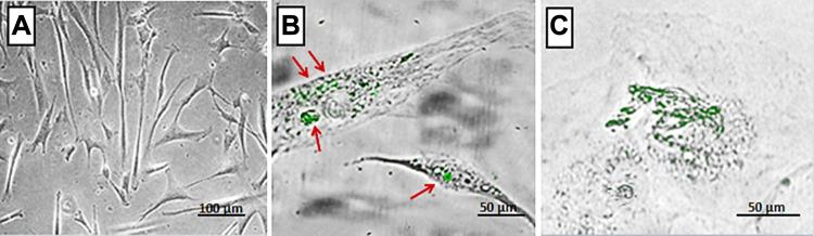 https://cdn.ncbi.nlm.nih.gov/pmc/blobs/e0f8/7814244/a07fc27a77d7/IJN-16-331-g0002.jpg