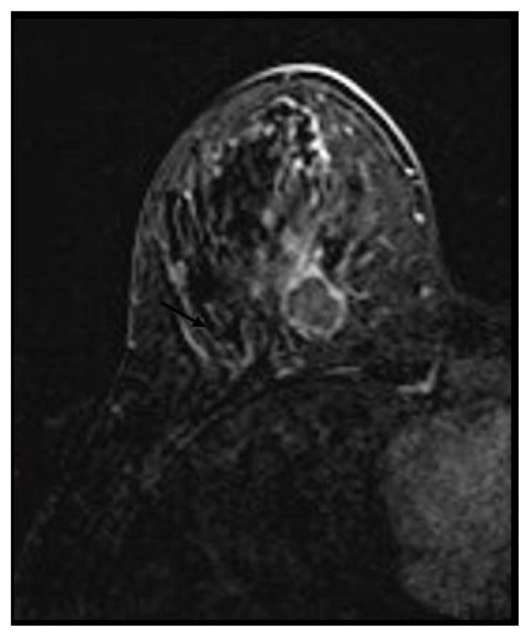 https://cdn.ncbi.nlm.nih.gov/pmc/blobs/e0fa/9785392/5353b4c2ddc7/medicina-58-01716-g004.jpg