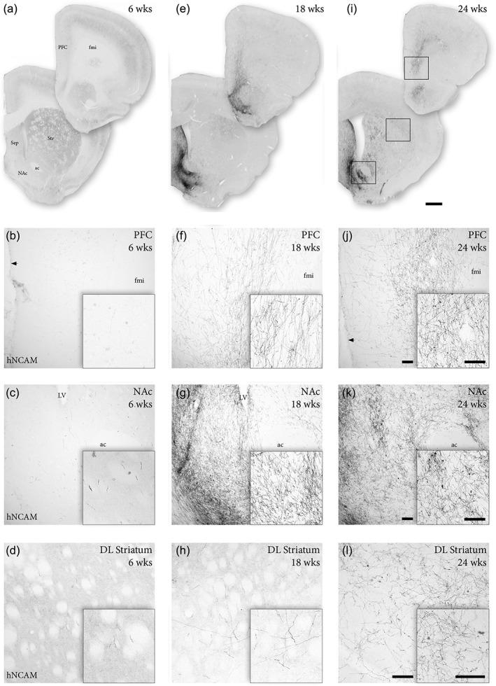 https://cdn.ncbi.nlm.nih.gov/pmc/blobs/e0fc/6175216/1a8765b5feae/CNE-526-2133-g003.jpg