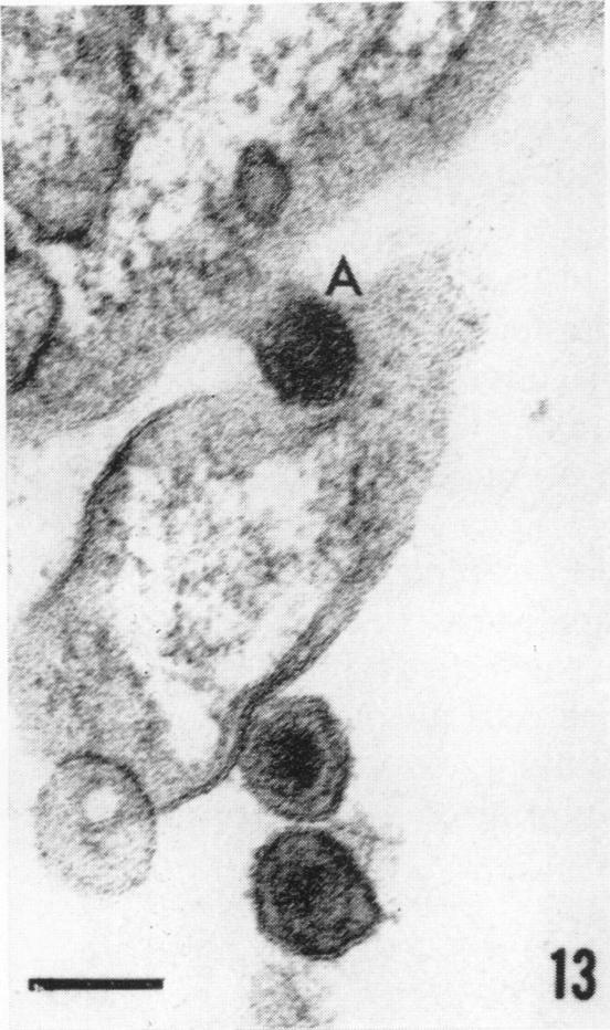 https://cdn.ncbi.nlm.nih.gov/pmc/blobs/e107/375605/b5d3b8ae1e47/jvirol00315-0073-b.jpg