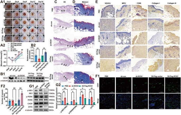 https://cdn.ncbi.nlm.nih.gov/pmc/blobs/e10a/12378791/e12f4b2c4e38/18_2025_5814_Fig8_HTML.jpg