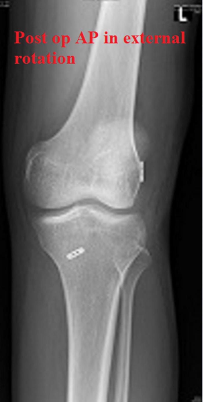 https://cdn.ncbi.nlm.nih.gov/pmc/blobs/e10d/6305945/5a473df38429/gr4.jpg
