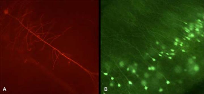 https://cdn.ncbi.nlm.nih.gov/pmc/blobs/e110/3592701/e5179582393c/june-8-44f3.jpg
