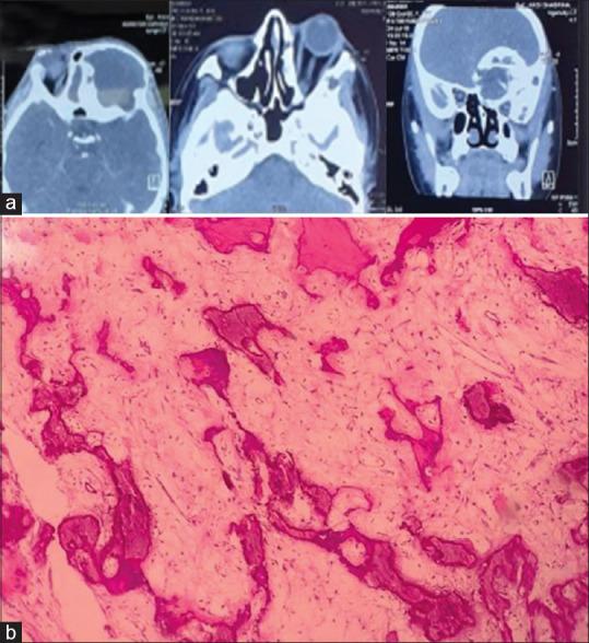 https://cdn.ncbi.nlm.nih.gov/pmc/blobs/e121/10474534/ff6e578f3dc4/NJMS-14-334-g001.jpg