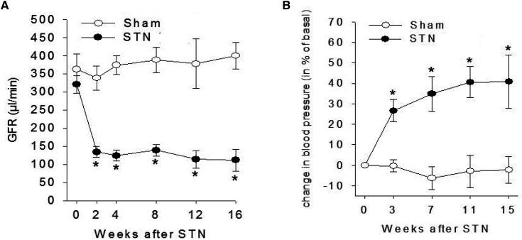 https://cdn.ncbi.nlm.nih.gov/pmc/blobs/e121/10476685/97bec68c1ba3/kidney360-4-1080-g002.jpg
