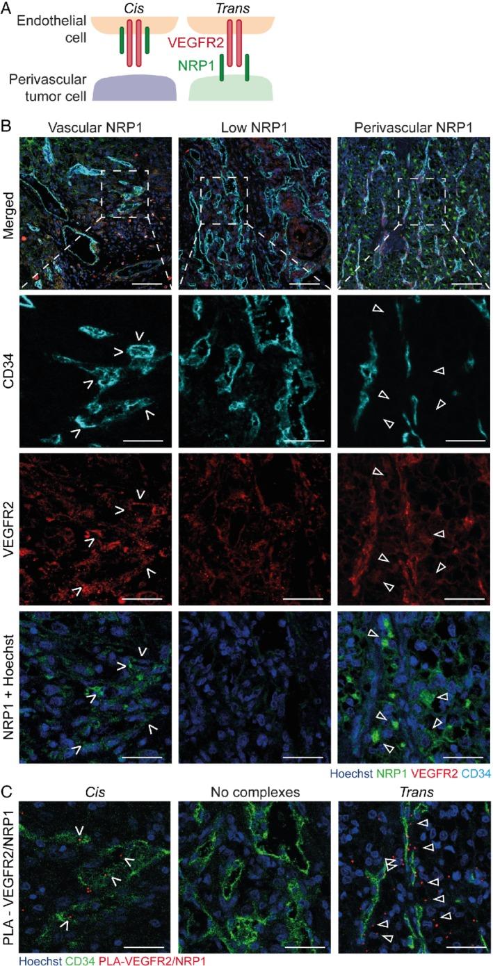 https://cdn.ncbi.nlm.nih.gov/pmc/blobs/e123/7155095/2f237cf087db/PATH-250-387-g001.jpg