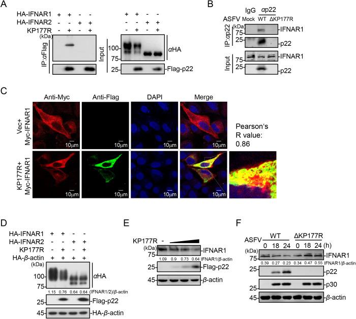 https://cdn.ncbi.nlm.nih.gov/pmc/blobs/e12a/12266391/2fbb76cd11cd/ppat.1013319.g004.jpg