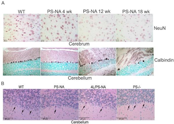 https://cdn.ncbi.nlm.nih.gov/pmc/blobs/e12b/2518924/6c67390b67da/1471-2202-9-76-3.jpg
