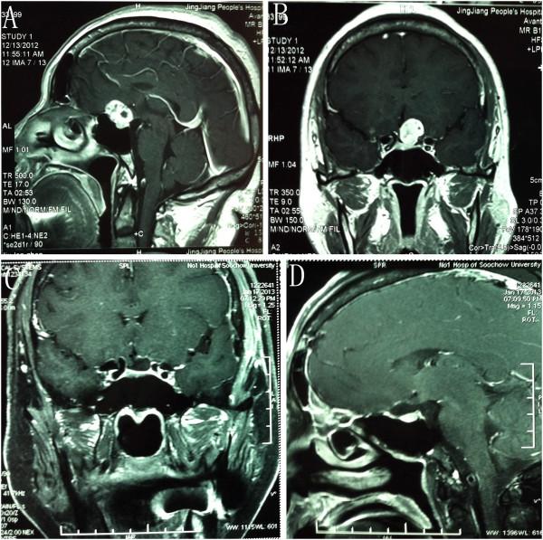 https://cdn.ncbi.nlm.nih.gov/pmc/blobs/e131/3631129/176c0351786d/1477-7819-11-41-8.jpg