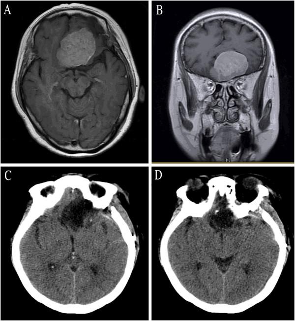 https://cdn.ncbi.nlm.nih.gov/pmc/blobs/e131/3631129/afe5d5f7e785/1477-7819-11-41-6.jpg
