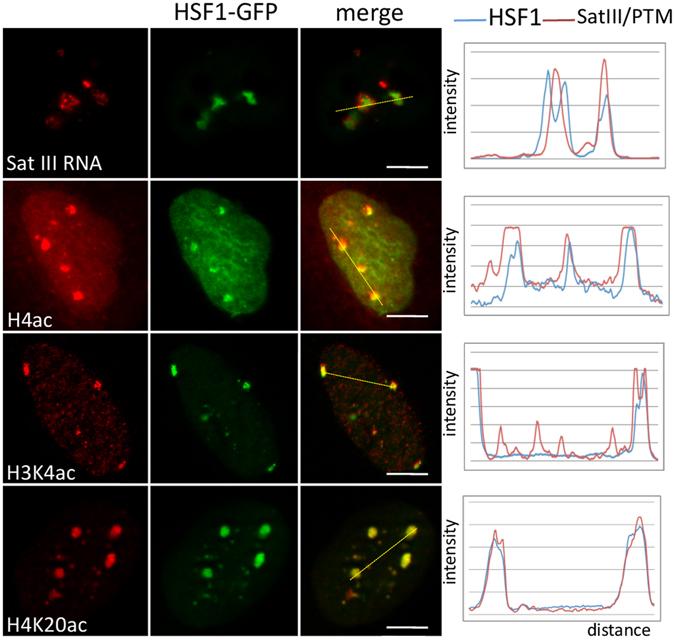 https://cdn.ncbi.nlm.nih.gov/pmc/blobs/e131/5511177/2521200e39f1/41598_2017_5343_Fig4_HTML.jpg
