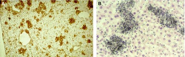 https://cdn.ncbi.nlm.nih.gov/pmc/blobs/e132/4231239/8fcaf7f1ce77/imr0262-0036-f4.jpg