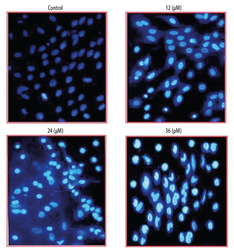 https://cdn.ncbi.nlm.nih.gov/pmc/blobs/e136/6798726/92cfac75bd63/medscimonit-25-7597-g002.jpg