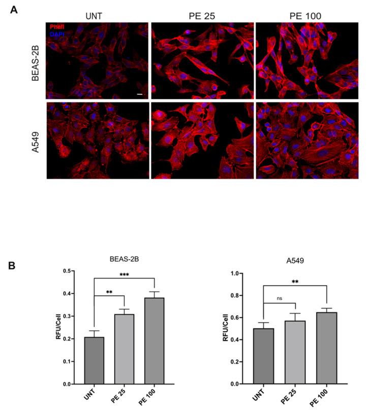 https://cdn.ncbi.nlm.nih.gov/pmc/blobs/e13a/11432389/0ca0f7de2989/ijms-25-10168-g002.jpg
