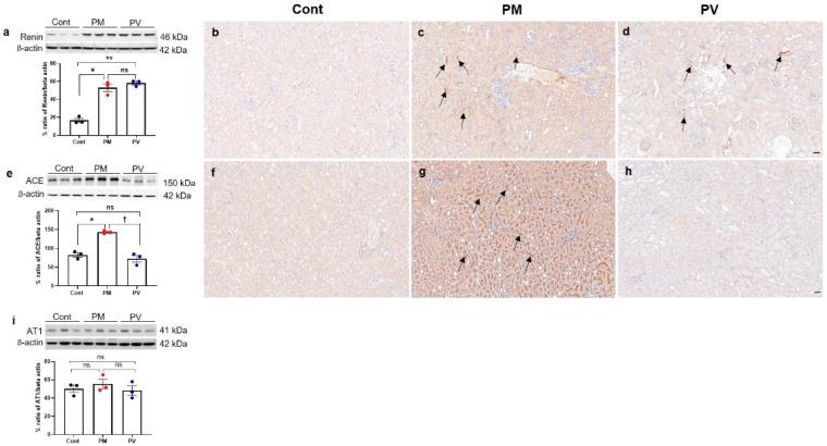 https://cdn.ncbi.nlm.nih.gov/pmc/blobs/e13b/12109430/7efde3fecb6e/biomedicines-13-01166-g005.jpg