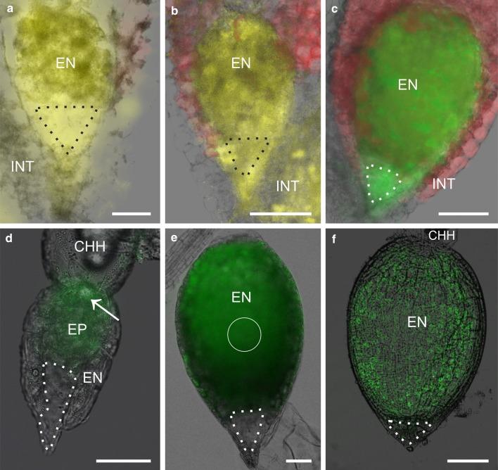 https://cdn.ncbi.nlm.nih.gov/pmc/blobs/e145/5310571/c474d0914725/425_2016_2619_Fig4_HTML.jpg