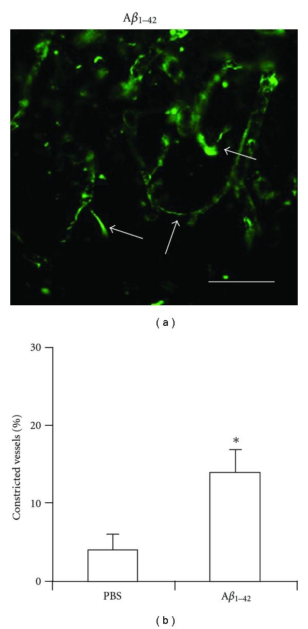 https://cdn.ncbi.nlm.nih.gov/pmc/blobs/e147/3182764/059165a17c99/IJAD2011-918280.003.jpg