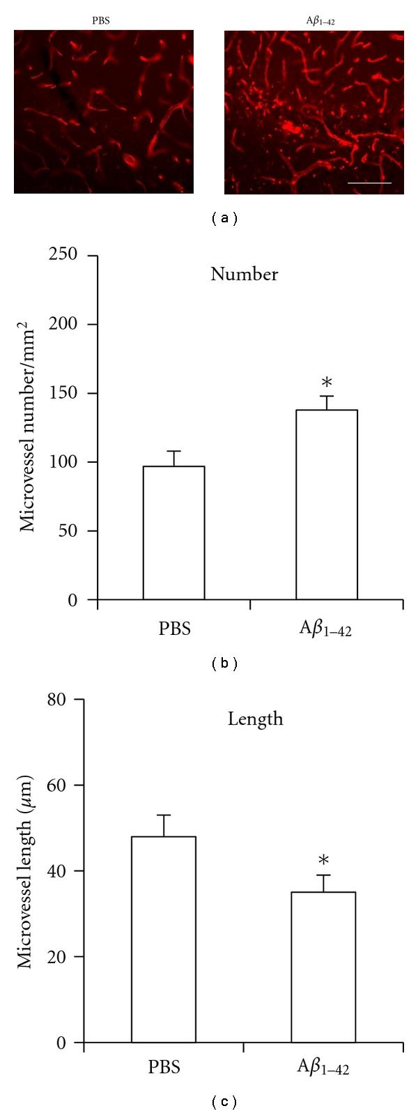 https://cdn.ncbi.nlm.nih.gov/pmc/blobs/e147/3182764/710097b705b8/IJAD2011-918280.001.jpg