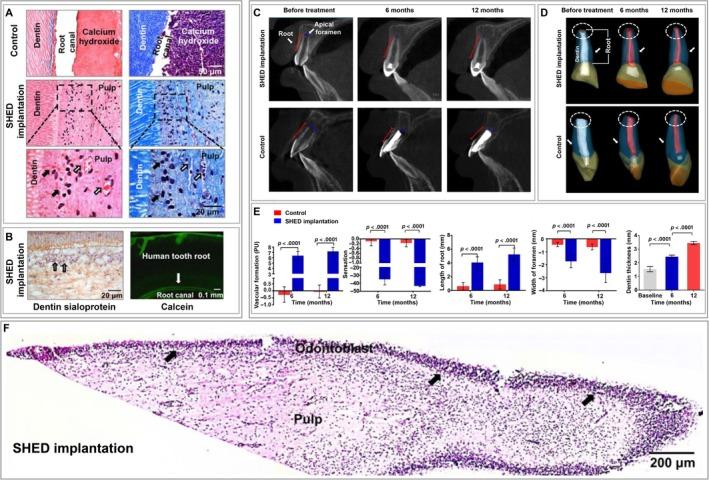 https://cdn.ncbi.nlm.nih.gov/pmc/blobs/e149/7103623/2224628b1701/SCT3-9-445-g003.jpg