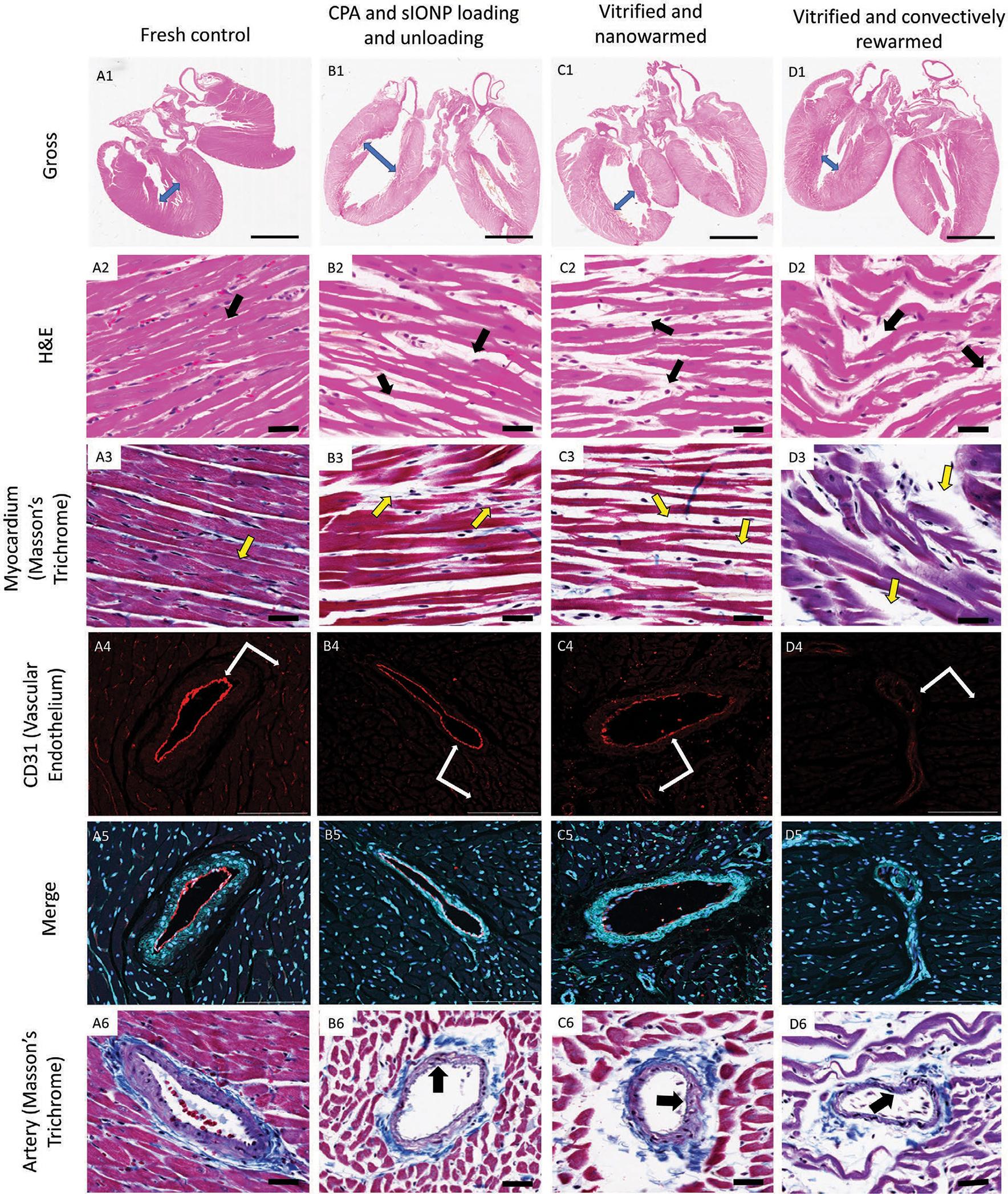 https://cdn.ncbi.nlm.nih.gov/pmc/blobs/e14e/9164386/83338681b199/nihms-1745591-f0008.jpg