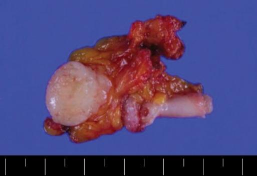https://cdn.ncbi.nlm.nih.gov/pmc/blobs/e14f/2998005/2c5983e49e65/jksc-26-302-g004.jpg