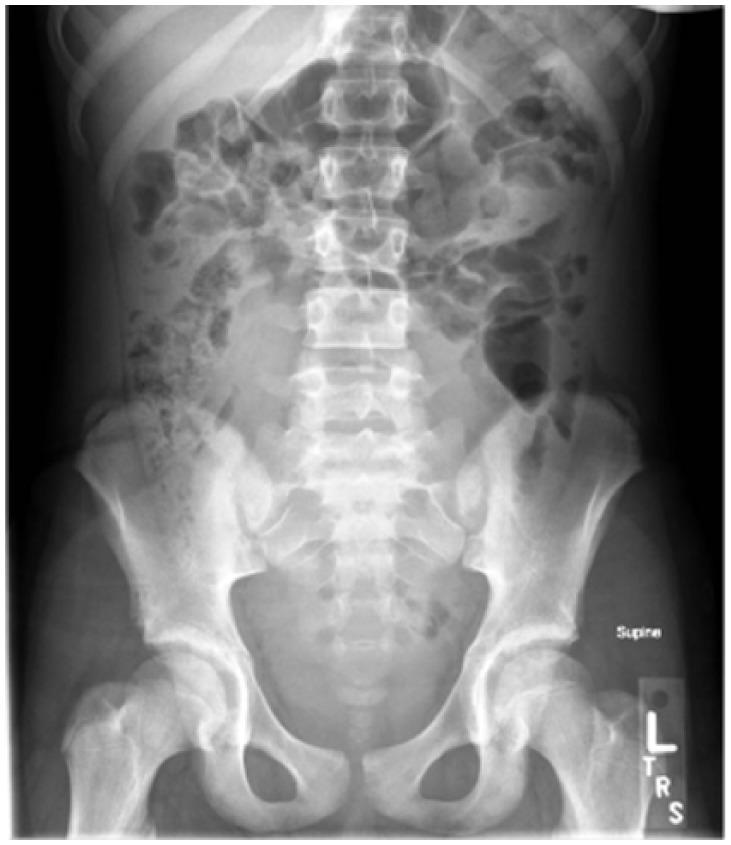 https://cdn.ncbi.nlm.nih.gov/pmc/blobs/e155/5946351/7e603d16b7ef/10.1177_2333794X18769817-fig1.jpg