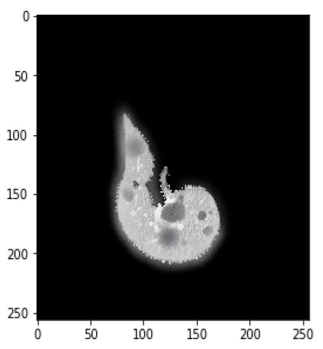 https://cdn.ncbi.nlm.nih.gov/pmc/blobs/e157/9404984/4584b5ed0c4a/bioengineering-09-00368-g005.jpg