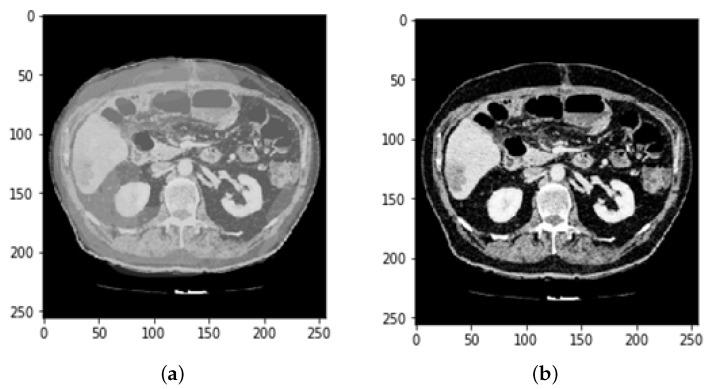https://cdn.ncbi.nlm.nih.gov/pmc/blobs/e157/9404984/4a55bd86855f/bioengineering-09-00368-g002.jpg
