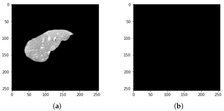 https://cdn.ncbi.nlm.nih.gov/pmc/blobs/e157/9404984/876006d294a9/bioengineering-09-00368-g013.jpg