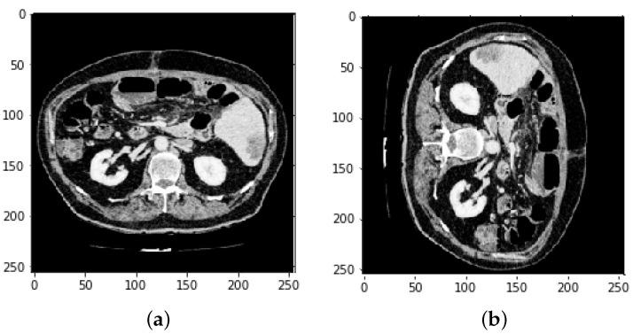 https://cdn.ncbi.nlm.nih.gov/pmc/blobs/e157/9404984/93646295b893/bioengineering-09-00368-g010.jpg