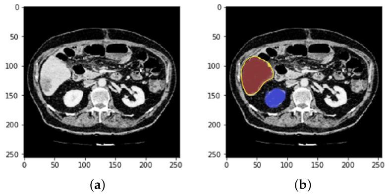 https://cdn.ncbi.nlm.nih.gov/pmc/blobs/e157/9404984/b01154805bc6/bioengineering-09-00368-g003.jpg