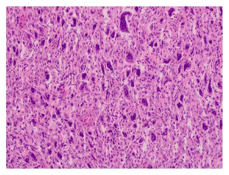https://cdn.ncbi.nlm.nih.gov/pmc/blobs/e169/4556817/e599fe06698d/CRIM2015-567543.003.jpg