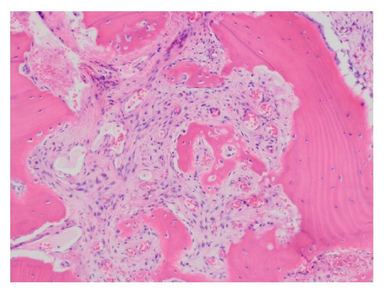https://cdn.ncbi.nlm.nih.gov/pmc/blobs/e169/4556817/fb8cf5598898/CRIM2015-567543.005.jpg
