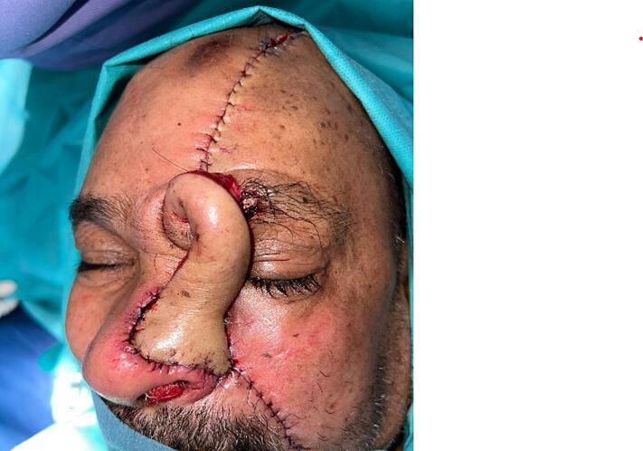 https://cdn.ncbi.nlm.nih.gov/pmc/blobs/e16c/10684999/e0f3a9a866eb/gr6.jpg