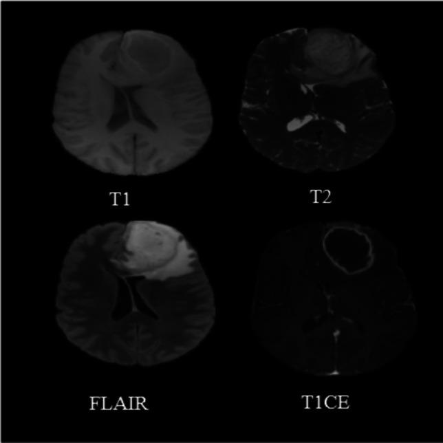 https://cdn.ncbi.nlm.nih.gov/pmc/blobs/e16d/11793220/55597816cf7c/432_2023_5566_Fig4_HTML.jpg