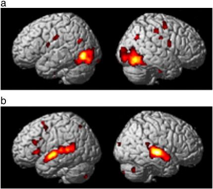 https://cdn.ncbi.nlm.nih.gov/pmc/blobs/e16d/2693529/29a7139d8e89/gr3.jpg