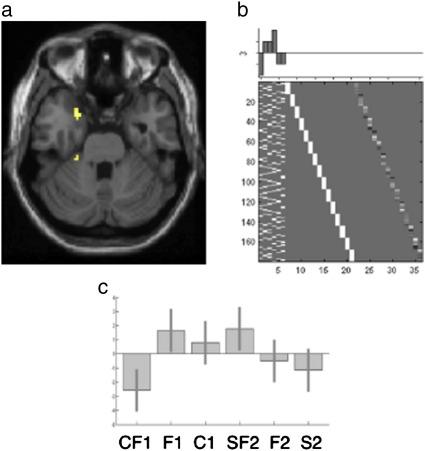 https://cdn.ncbi.nlm.nih.gov/pmc/blobs/e16d/2693529/4286af2730a3/gr4.jpg