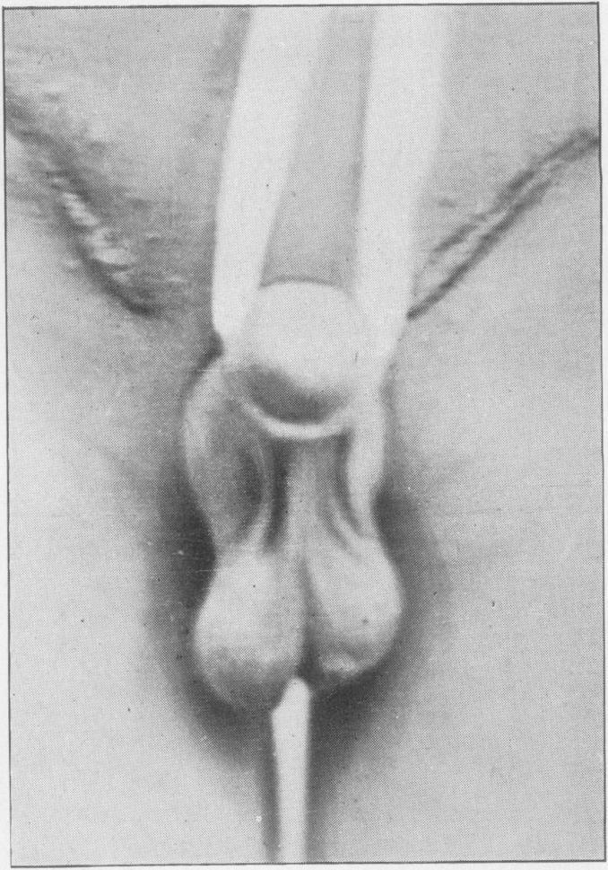 https://cdn.ncbi.nlm.nih.gov/pmc/blobs/e173/1997671/10fb115dcb3a/procrsmed00666-0133-b.jpg