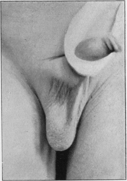 https://cdn.ncbi.nlm.nih.gov/pmc/blobs/e173/1997671/1bcf328e04e5/procrsmed00666-0126-c.jpg