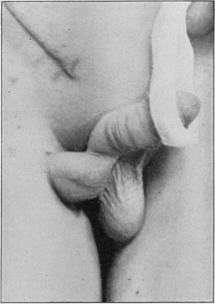 https://cdn.ncbi.nlm.nih.gov/pmc/blobs/e173/1997671/68865b33499e/procrsmed00666-0134-b.jpg